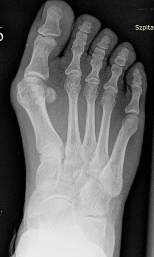 dr n. med Michał Pyda Specjalista Ortopeda Traumatolog